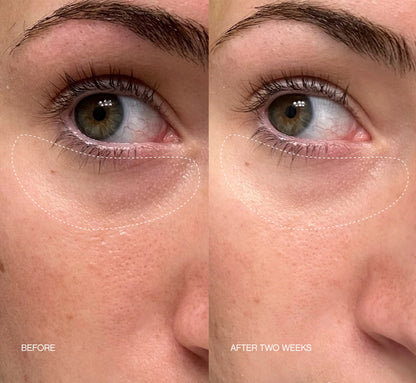 Faded Under Eye Masks